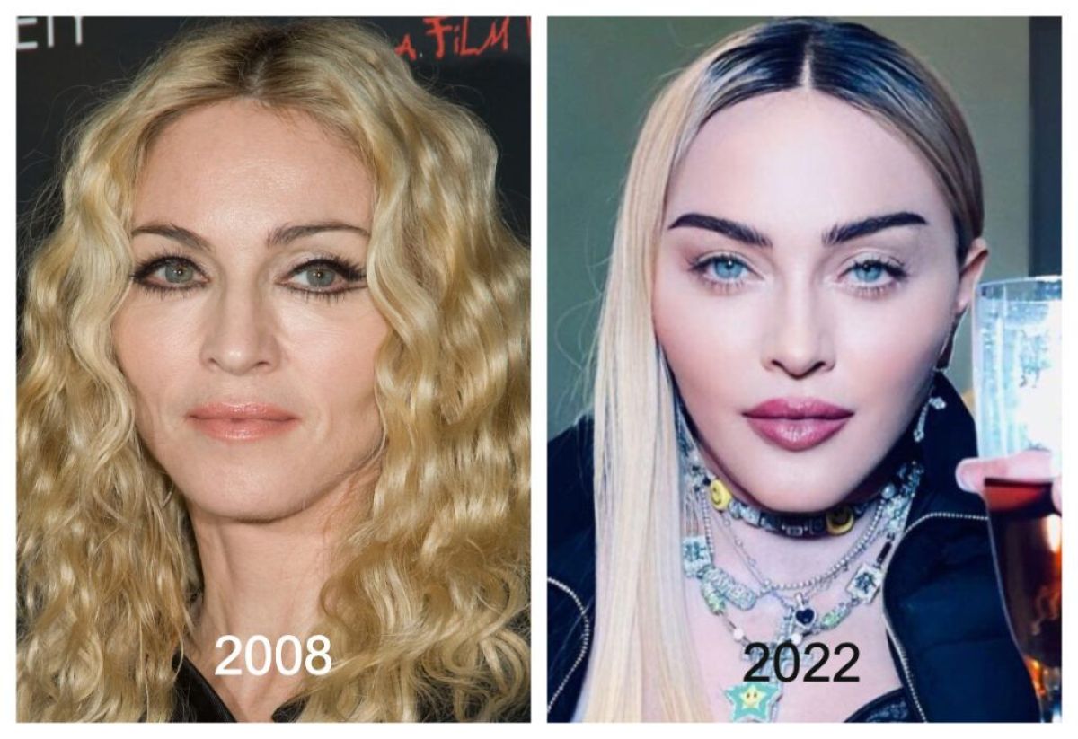 El impactante nuevo rostro de Madonna: "Parece una...